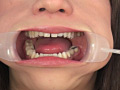 フェチ選！！ 口腔歯科淫診のサンプル画像20