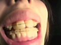 [gripav-0079] 鼻フック＆開口器 唾ダラ穴剥け歯列矯正娘 リョウコのキャプチャ画像 9