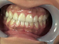 熟成唾液が滴り落ちる濃厚な顔舐めと口腔歯科不倫 サンプル画像8