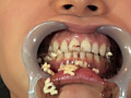 熟成唾液が滴り落ちる濃厚な顔舐めと口腔歯科不倫 サンプル画像12