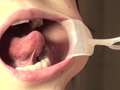 [gripav-0154] フェチ選！！羞恥歯科医淫！おっぴろげ口腔紀行のキャプチャ画像 10
