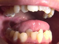 GRAV-143 素人対抗顔舐め狂宴！！総天然歯並びコレクション 無料画像15