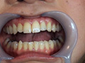 銀歯4本口腔鑑賞＆全身くすぐり 清純派60ミリ長舌の執拗な鼻フェラベロほじり 源かのこのサンプル画像2