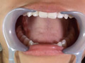 フェチ選！！ AV女優専門口腔歯科医院のサンプル画像2