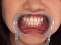 フェチ選！！ AV女優専門口腔歯科医院のサンプル画像5