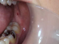 [gripav-0248] フェチ選！！AV女優専門口腔歯科医院のキャプチャ画像 9