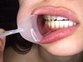 銀歯4本＆矯正具付き口腔視姦と咀嚼顔舐め接吻のサンプル画像4