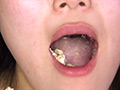 銀歯4本＆矯正具付き口腔視姦と咀嚼顔舐め接吻 サンプル画像6
