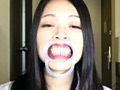 [gripav-0405] 銀歯vs虫歯を発見！ダブル口腔淫診ショー