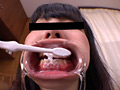 [haisetsu-0125] お姉さん達の口の中 口腔観察で感じる女達のキャプチャ画像 2