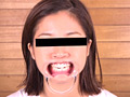 [haisetsu-0125] お姉さん達の口の中 口腔観察で感じる女達のキャプチャ画像 5