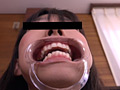 [haisetsu-0125] お姉さん達の口の中 口腔観察で感じる女達のキャプチャ画像 7
