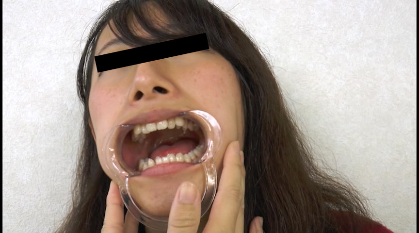 歯、痛いですか？ 素人娘たちの意識調査 画像8