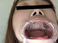 歯、痛いですか？ 素人娘たちの意識調査 画像2