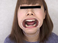 歯、痛いですか？ 素人娘たちの意識調査 画像5