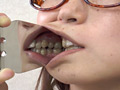 歯、痛いですか？ 素人娘たちの意識調査 画像7