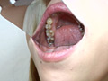 歯、痛いですか？ 素人娘たちの意識調査 画像12