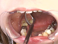 歯、痛いですか？ 素人娘たちの意識調査 画像14