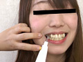 歯、痛いですか？ 素人娘たちの意識調査 画像15