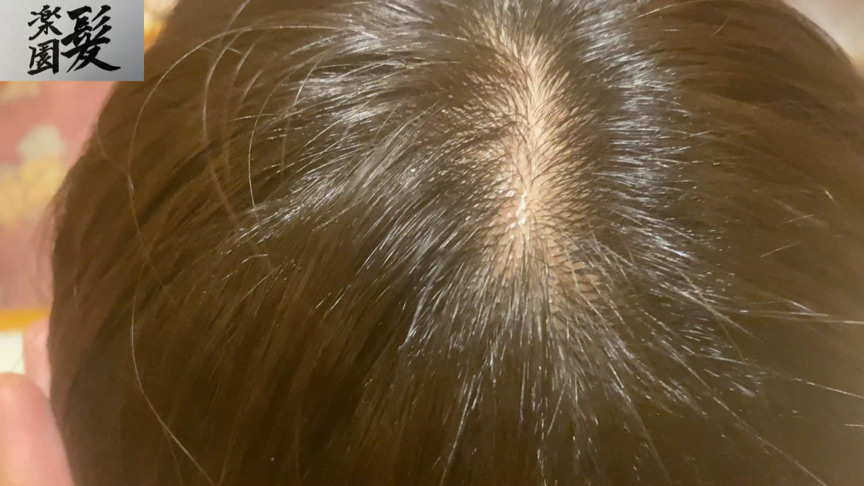 髪楽園No.6茶黒ショート前編 画像4