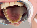 [kyuuhendan-0008] 【歯フェチ】プチ口内観察 きほの口の中のキャプチャ画像 2