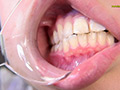 [kyuuhendan-0008] 【歯フェチ】プチ口内観察 きほの口の中のキャプチャ画像 3