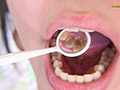 【歯フェチ】プチ口内観察 きほの口の中 サンプル画像5