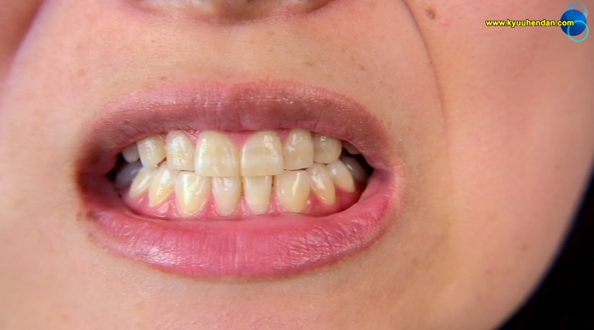 【歯フェチ】プチ口内観察宮永の口の中 | DUGAエロ動画データベース