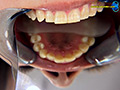 【歯フェチ】プチ口内観察宮永の口の中 サンプル画像7