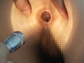 肛門科医師の女子校生アナル診察のサンプル画像2