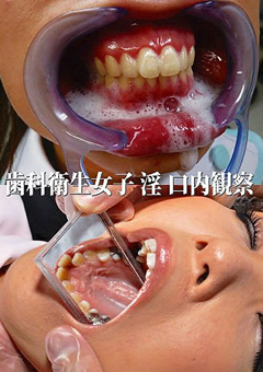 歯科衛生女子 淫 口内観察