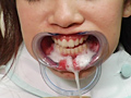 歯科衛生女子 淫 口内観察のサンプル画像11