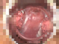 子宮口むき出しオナニーのサンプル画像10
