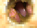 子宮口 糞塗りたくりオナニーのサンプル画像17
