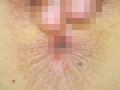 ぎょう虫検査と称して陰部や肛門を弄ばれる制服女子 サンプル画像6