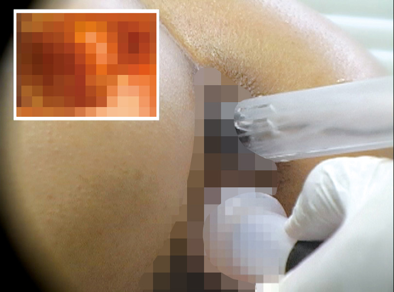 肛門内健診 患者のアナル（秘穴）を弄ぶセクハラ医師 画像3