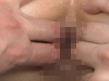 肛門ビッチが通うアナル拡張クリニック サンプル画像13