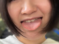 街角口内01