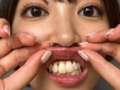 街角口内02