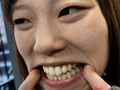 街角で声をかけて口内観察させてもらう オーガニックスーパー勤務 はつみちゃん