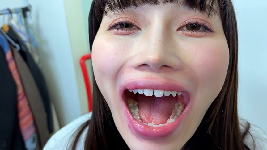 街角で声をかけて口内観察させてもらう ひなみちゃん 画像4