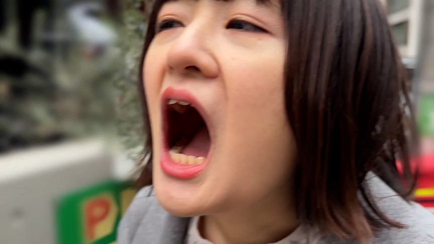 街角で声をかけて口内観察させてもらう みこちゃん 画像1