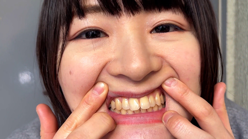 街角で声をかけて口内観察させてもらう みこちゃん 画像3