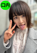 街角で声をかけて口内観察させてもらう みこちゃん