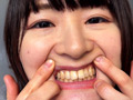街角で声をかけて口内観察させてもらう みこちゃん サンプル画像3