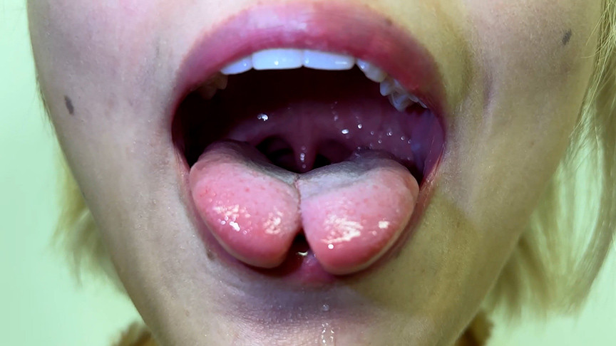 街角で声をかけて口内観察させてもらう はるのちゃん 2枚目