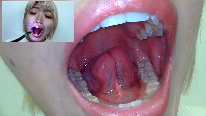 街角で声をかけて口内観察させてもらう はるのちゃん 5枚目