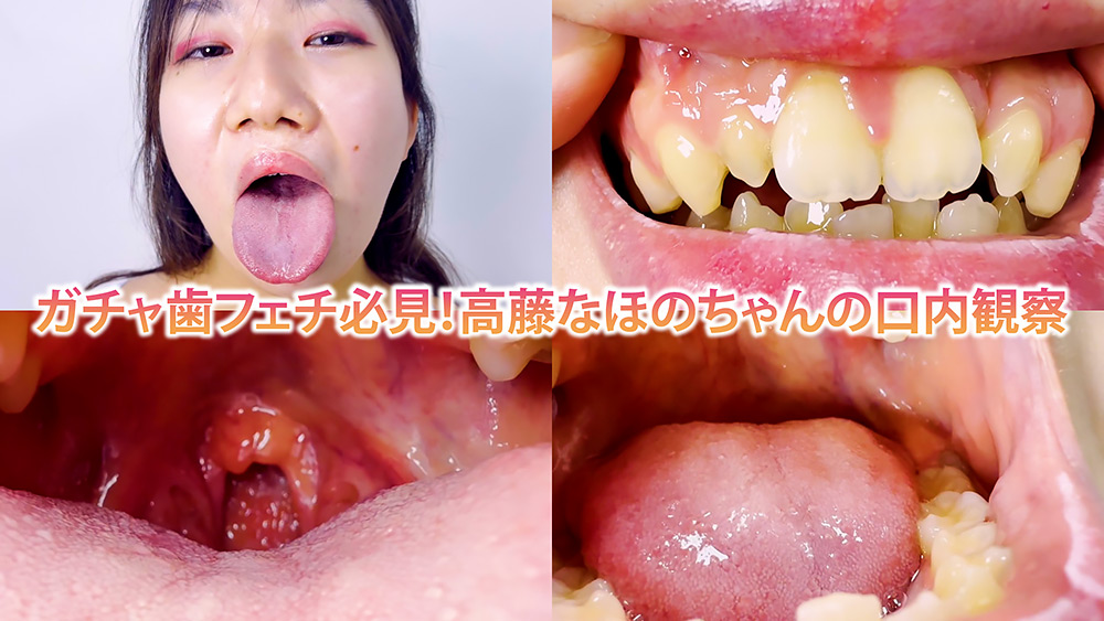 ガチャ歯フェチ必見！高藤なほのちゃんの口内観察