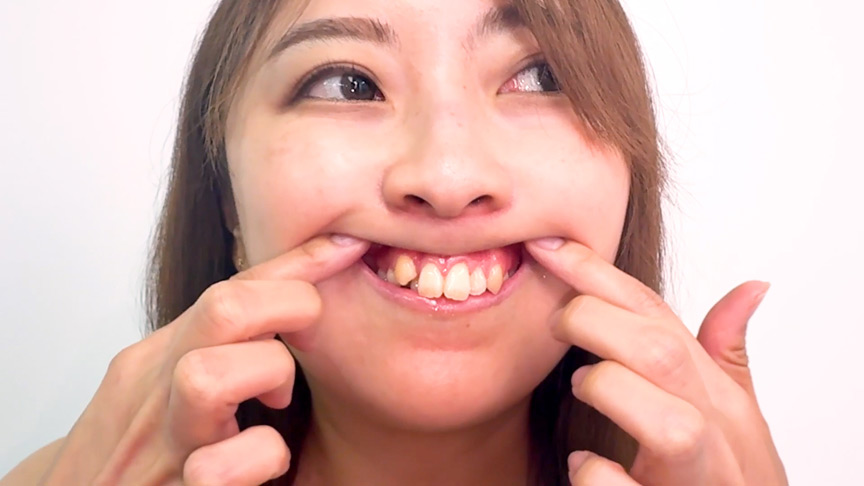 食いしん坊なのに口内美人！弓山ゆきちゃんの口内観察 画像3
