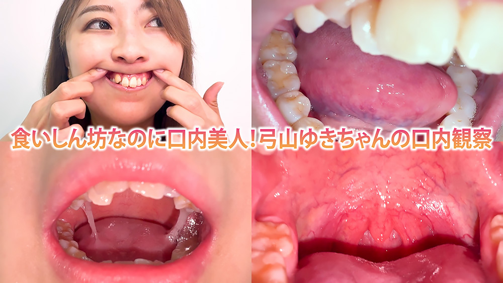 食いしん坊なのに口内美人！弓山ゆきちゃんの口内観察